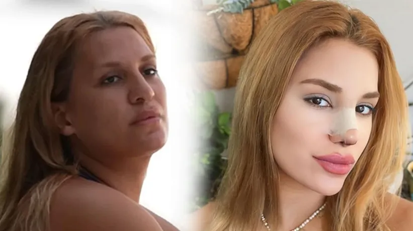 Survivor'dan sonra çok değişti! Almeda Baylan'dan şaşırtan karar!
