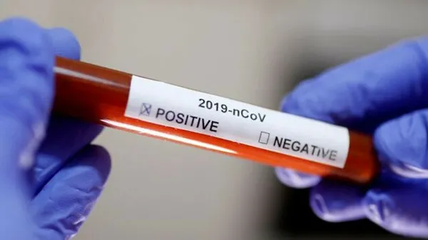 can-kaybi-2-milyonu-gecti-hangi-ulkede-koronavirus-nedeniyle-kac-kisi-hayatini-kaybetti-1612279782826.jpg Can kaybı 2 milyonu geçti! Hangi ülkede koronavirüs nedeniyle kaç kişi hayatını kaybetti? - 13