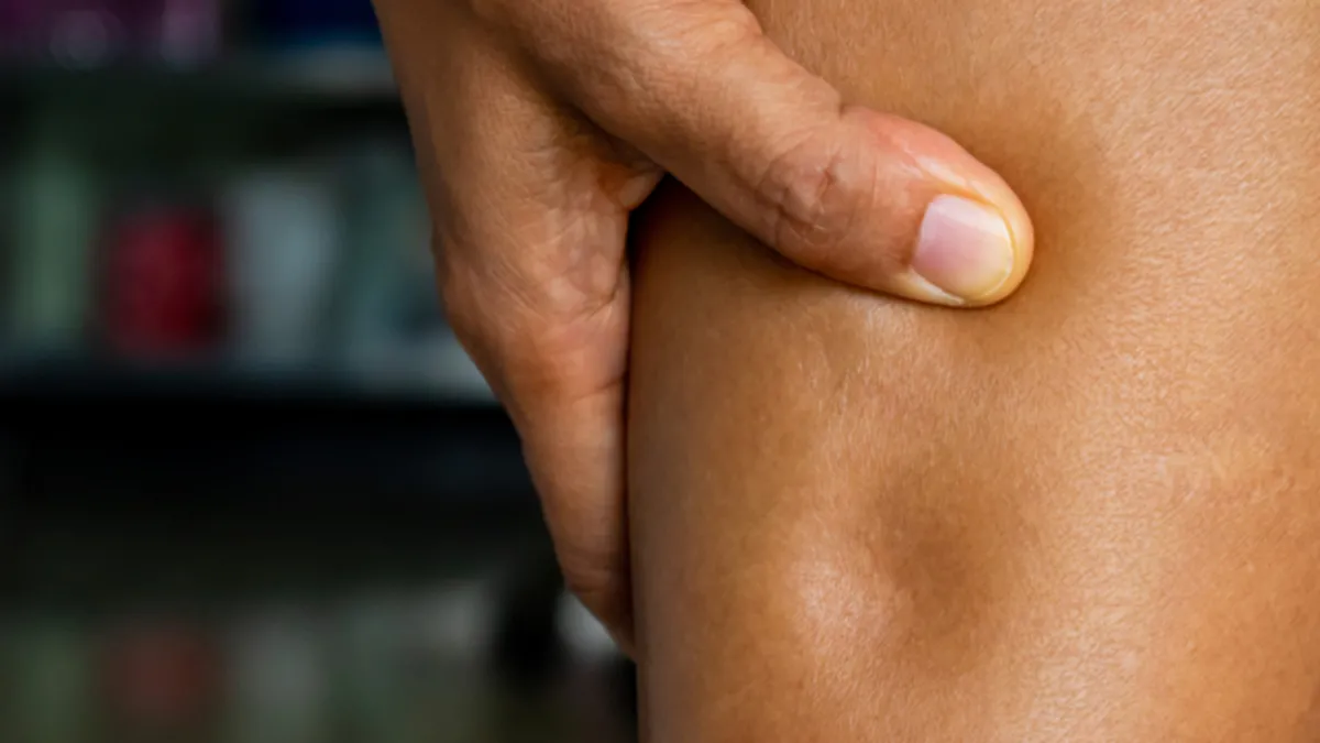 Ödem vücuttan nasıl atılır? İşte ödem söktürücü detoks içeceği...