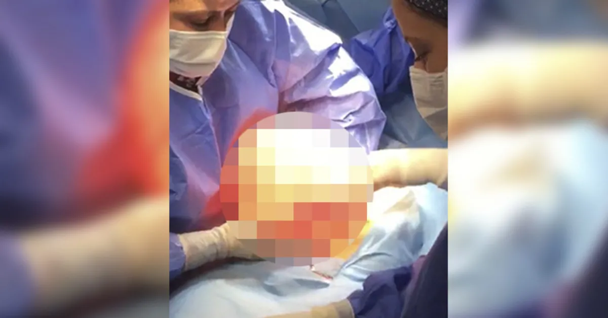 Genç kıza halk otobüsü çarptı! Karnından çıkanı görenler şoke oldu: İyi ki çarpmış diye dua ediyorum