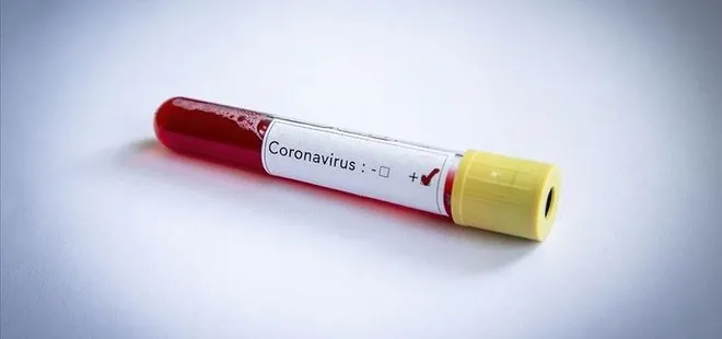 Son dakika: Mehmet Sepil’in koronavirüs testi pozitif çıktı!