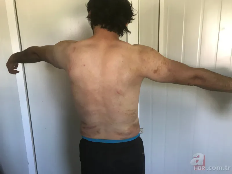 Yunanistan polisinin ‘göçmen zulmü’ devam ediyor 7