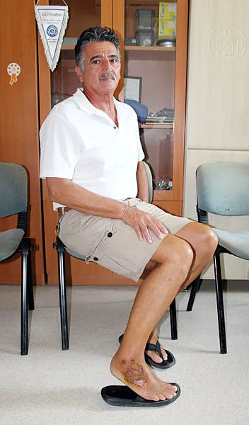Antalya'da korkunç olay! Ayağına düşen 'aslan balığı' öldürüyordu - 1