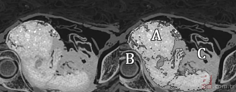 Doğmamış çocuğuyla mumyalandı: 2 bin yıl nasıl bozulmadan kaldı? "Gerçek bir insanlık trajedisi" 5
