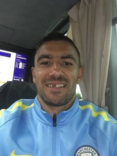 Kolarov, dişinin kırıldığını derbiden sonra farketti! - 1