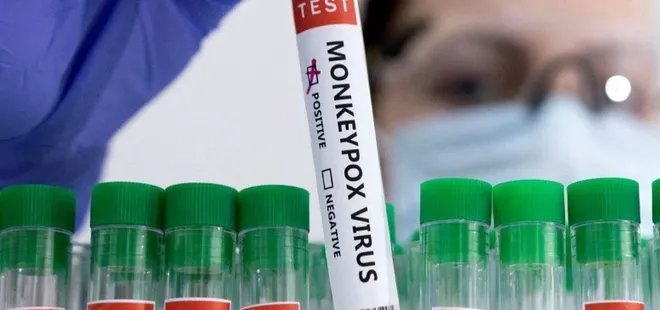 ABD’nin 7 eyaletinde maymun çiçeği virüsü alarmı