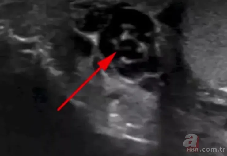 Doktora gitti hayatının şokunu yaşadı 👨⚕️ Sivrisinek ısırığı kabusu oldu 🦟 Dans eden düzinelerce... 4