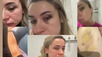 Elif öğretmenin darp paylaşımı gündem olmuştu: Eski enişteye tekme tokat linç