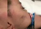 Küçük kız kan kusuncaya kadar dövüldü!