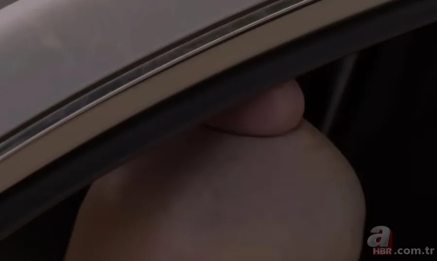 Sokağa şapka ile çıkıyordu! Başındaki şişlikten bakın ne çıktı 👩⚕️ Görenleri şaşkına çeviren olay 14