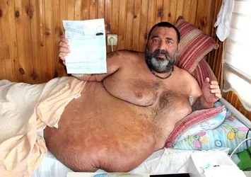 300 kilo ağırlığında ve yüzde 92 engelli adam yataktan kalkamıyor