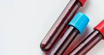 Dünyanın en değerli kanı: Rh-null! Nadir bulunuyor, altın kan olarak anılıyor