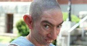 Ünlü oyuncu tanınmaz hale geldi!