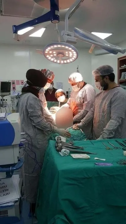Giderek kilo almaya başladı soluğu doktorda aldı! Karnından çıkanı görünce gözlerine inanamadı 👨⚕️ Ameliyat sonrası 9 kilo zayıfladı