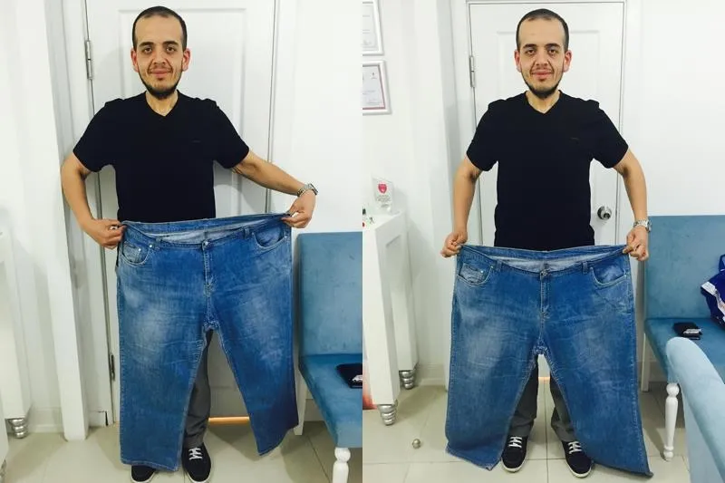 "MR cihazına sığamazsınız" dediler 84 kilo zayıfladı - 1