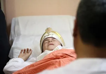 Sünnetin enfeksiyonsuz iyileşmesi için en uygun zaman "yaz tatili" dönemi