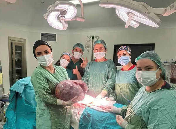1700824988869.jpg Hastanın karnından çıkan kitle şoke etti! 50 santimetre 20 kilogram! Doktor böyle poz verdi... - 2