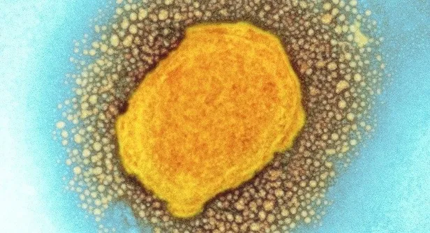 Maymun çiçeği virüsü nedir? Türkiye’de görüldü mü? Maymun çiçeği hastalığı nasıl bulaşır, belirtileri neler?