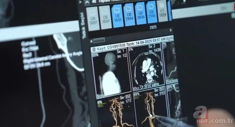 Ağızdan vücuda sinsice yayılan tehlikeye dikkat! Çok ciddi sonuçları var: Kalbe doğrudan vuruyor 4