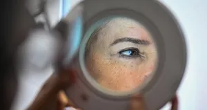 Yazın güneş koruması şart