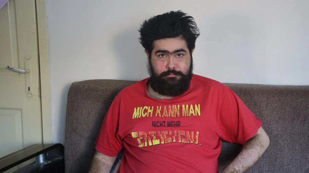 Depremin yıktığı hayat: "İstesem düzelirim ama istemiyorum! Barış Özbay'ın yürek yakan hikayesi