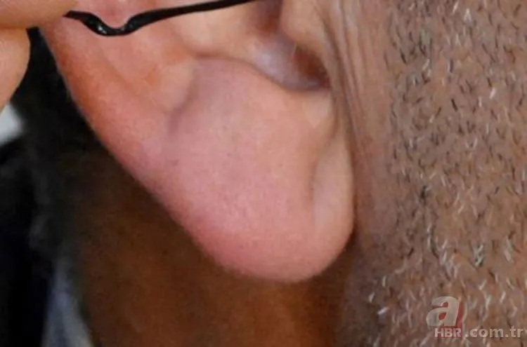 Kulak memesindeki çapraz çizgi ne işe yarar? 4