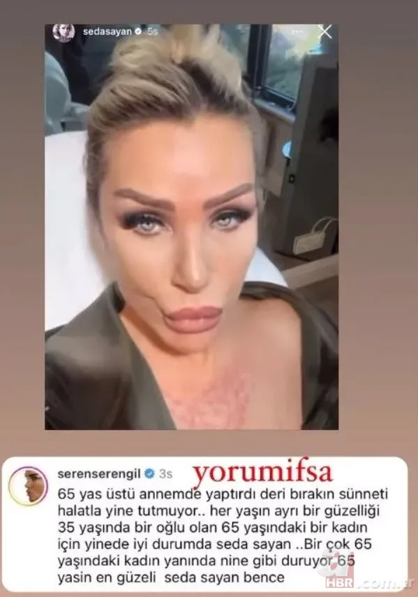 Seda Sayan’dan sünnet derisi açıklaması! Bu kez kız: Tek söyleyen benim!
