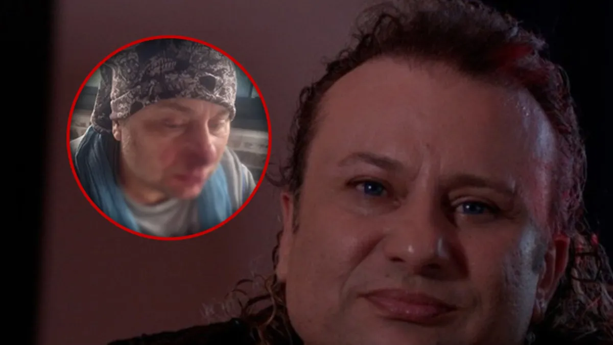 Onur Akay'ın burnu parçalandı! Başıboş pitbullun saldırısına uğradı