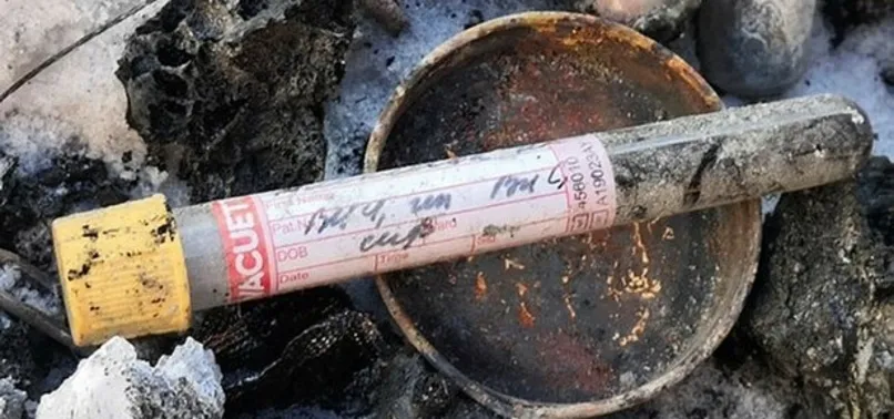 Rusya'da insan eti parçaları bulundu