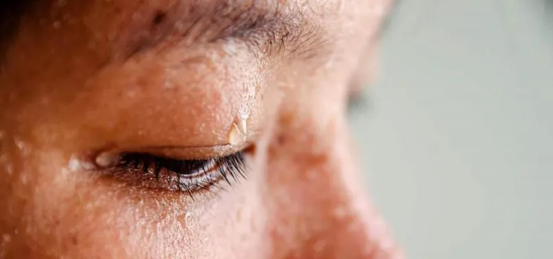 Aşırı terleme sorunu nedeniyle hastaneye gitti, sebebini öğrenince şoke oldu |Video