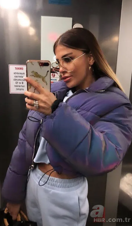 Adanalı dizisinin güzel oyuncusu Tuğçe Özbudak yeni haliyle olay oldu! Estetik yaptırmaktan öyle bir hale geldi ki... 9