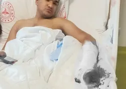 Kilis'te yürek yakan iş kazası! 5 parmağını kaybeden genç 8 aydır iş arıyor