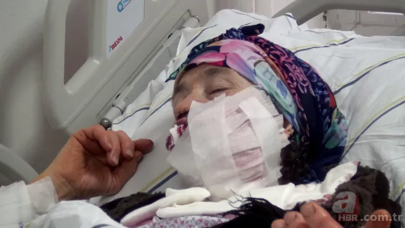 Hayvanlarını beslemek için ahıra giden kadın dehşeti yaşadı 🐄 Kurt birden saldırıp çenesini ısırdı 🐺 3