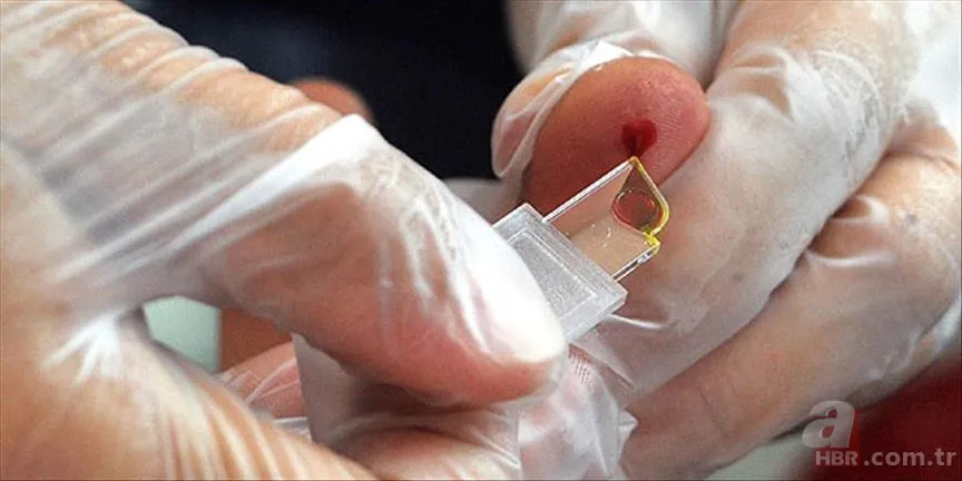 Dünyada sadece 43 kişide bulunan en değerli kan grubu! 3