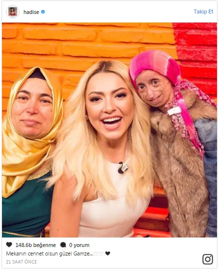 Hadise’yi yıkan ölüm haberi - 1
