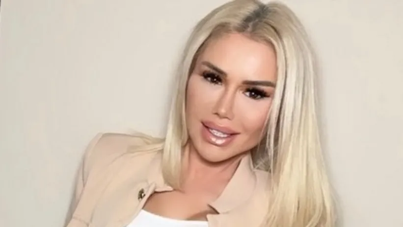 Ceylan’dan estetik itirafı: Asla yaptırmıyorum