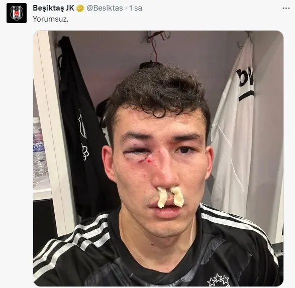 Beşiktaş’ta korkutan sakatlık! Zaynutdinov hastaneye kaldırıldı