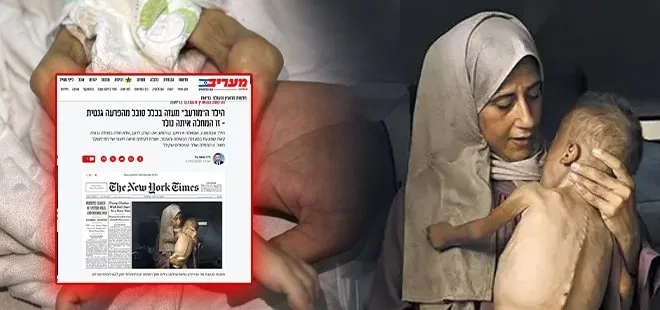 İsrail’den NYT’nin manşete taşıdığı acı fotoğrafa pişkin sözler! Açlık silahına genetik hastalık kılıfı