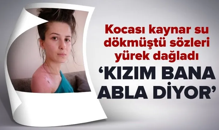 Kocası kaynar suyla haşlamıştı! Rukiye Ay’ın sözleri yürek dağladı