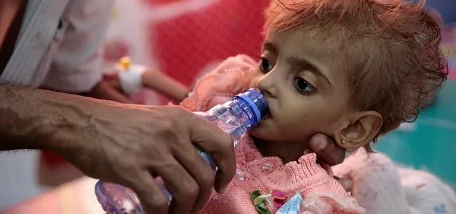 Yemen, dünyanın en büyük insani krizlerinden birini yaşıyor