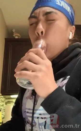 Fatih’te estetik yaptıran Bulgar modelin hayatı kabusa döndü! ‘Örümcek ağı’ operasyonu bakın ne hale getirdi? 10