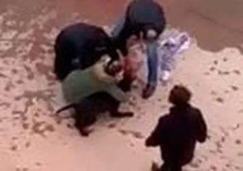 Pitbull köpeğinin saldırdığı Asiye'nin yüzünde iz kalacak mı? Asiye'nin tedavisi ne kadar sürecek? Prof. Dr. Özlenen Özkan açıkladı