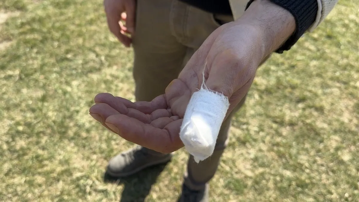 Parkta başıboş pitbull dehşeti! Köpeği ile parkta gezen vatandaş saldırıya uğradı