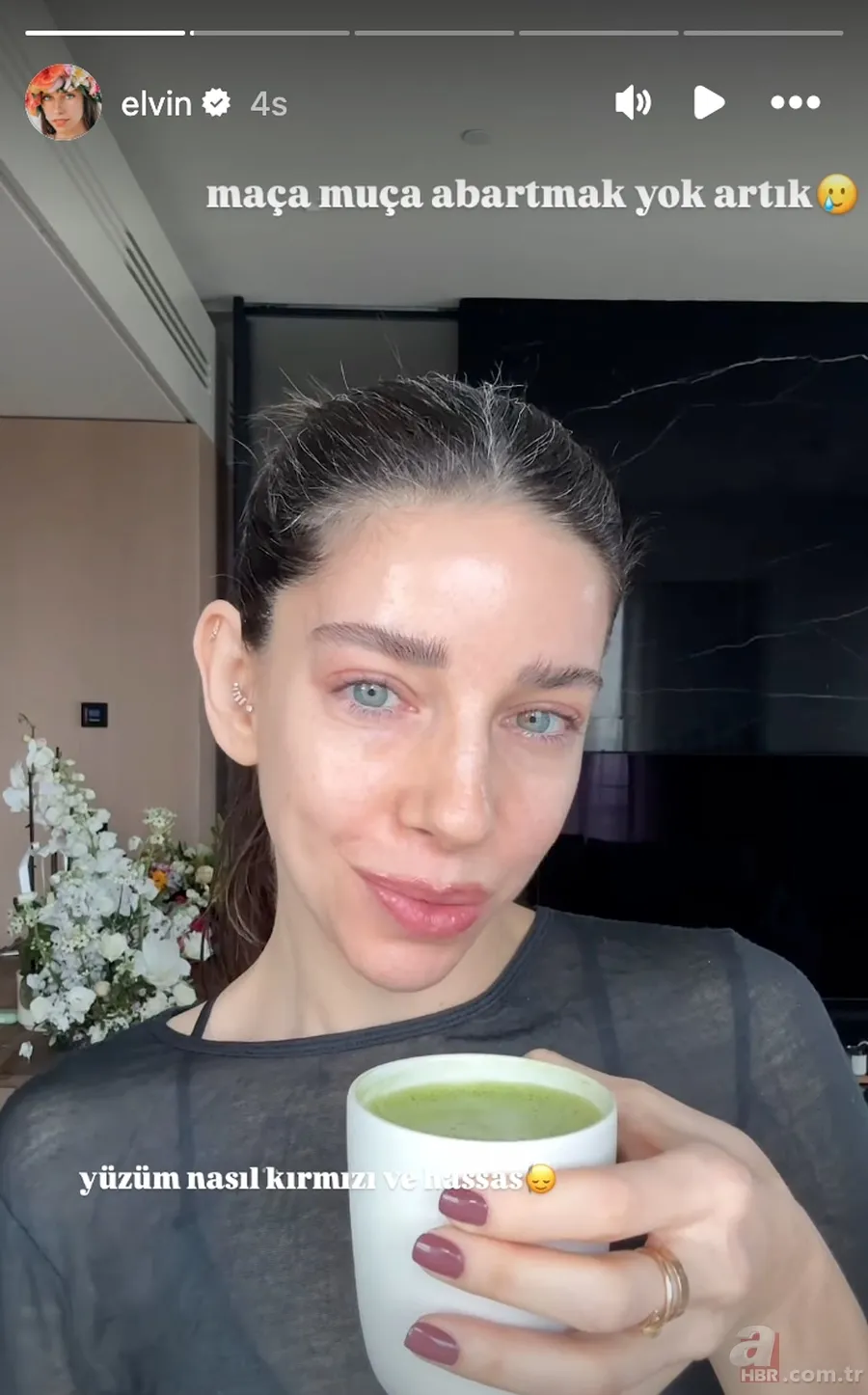 Elvin Levinler'in doktoru uyardı! "Artık abartmak yok" Kalp ameliyatı sonrası... 6