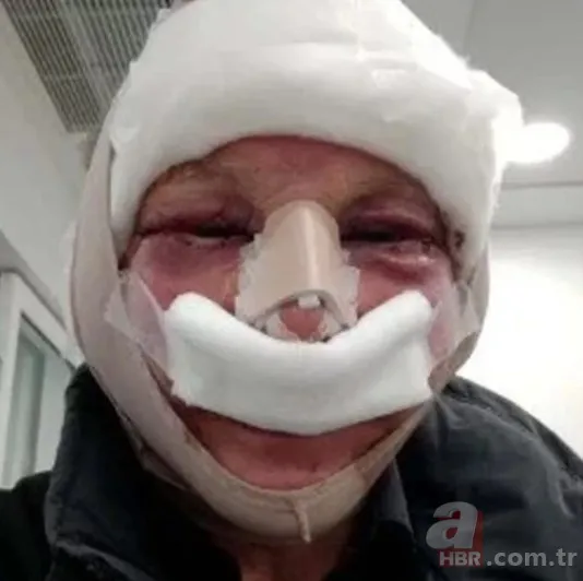 3 senedir gözlerini kapatamıyor! Sağlığına kavuşmak için Türkiye’ye geldi 12