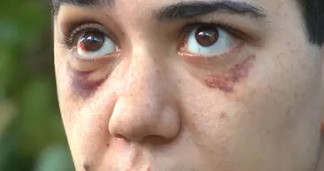 Beyaoğlu’nda kan şiddet: 23 yaşındaki kızı döve döve felç etti!