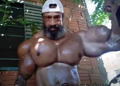 Brezilyalı Hulk’un feci sonu! Daha büyük kaslar istedi yaptıkları sonunu getirdi