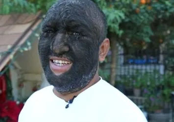 Dünyanın en kıllı adamı artık mutlu!