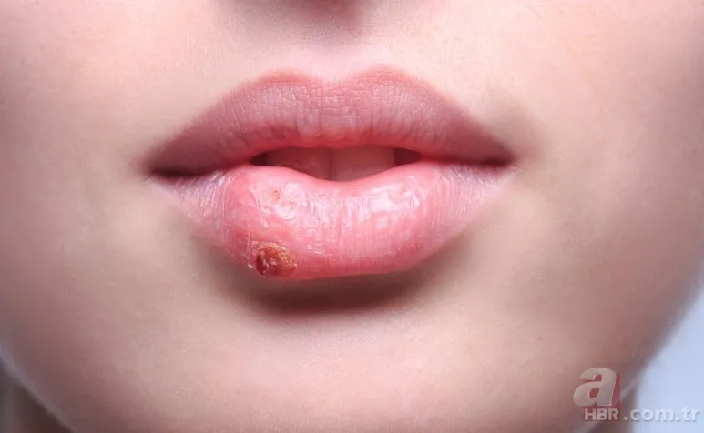 Meğer 1000 yıl önce yazmış! İbni-i Sina'nın şifa dağıtan tarifleri! Hastalıkları kökünden kazıyor! İşte o reçete 3