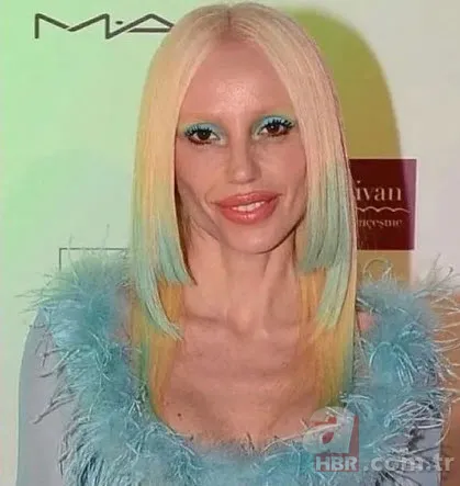 Gülşen estetiği abarttı! Son hali hayal kırıklığı yarattı: "Aysel Gürel olmuşsun" 5